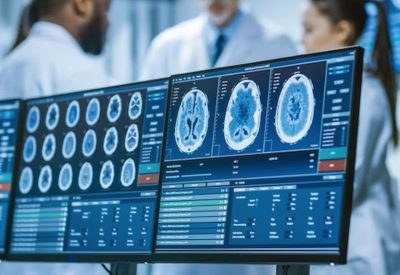 Two medical monitors with brain imaging